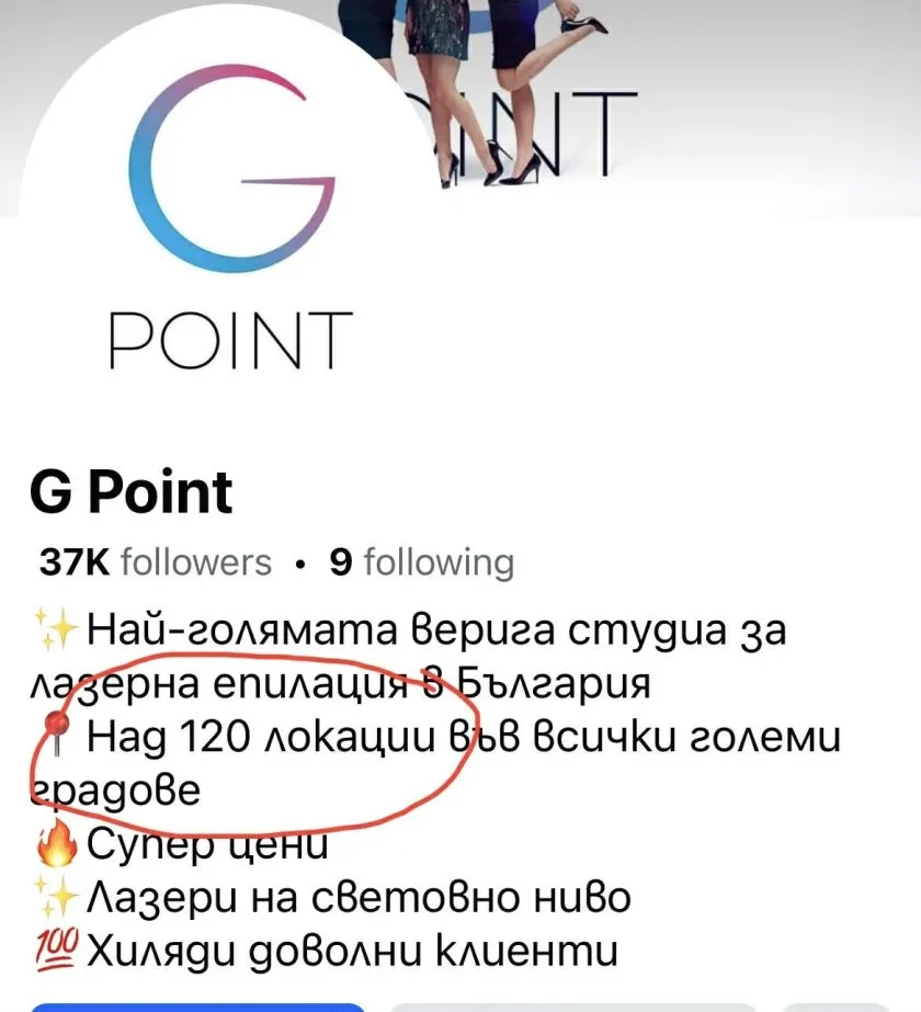 Епилация